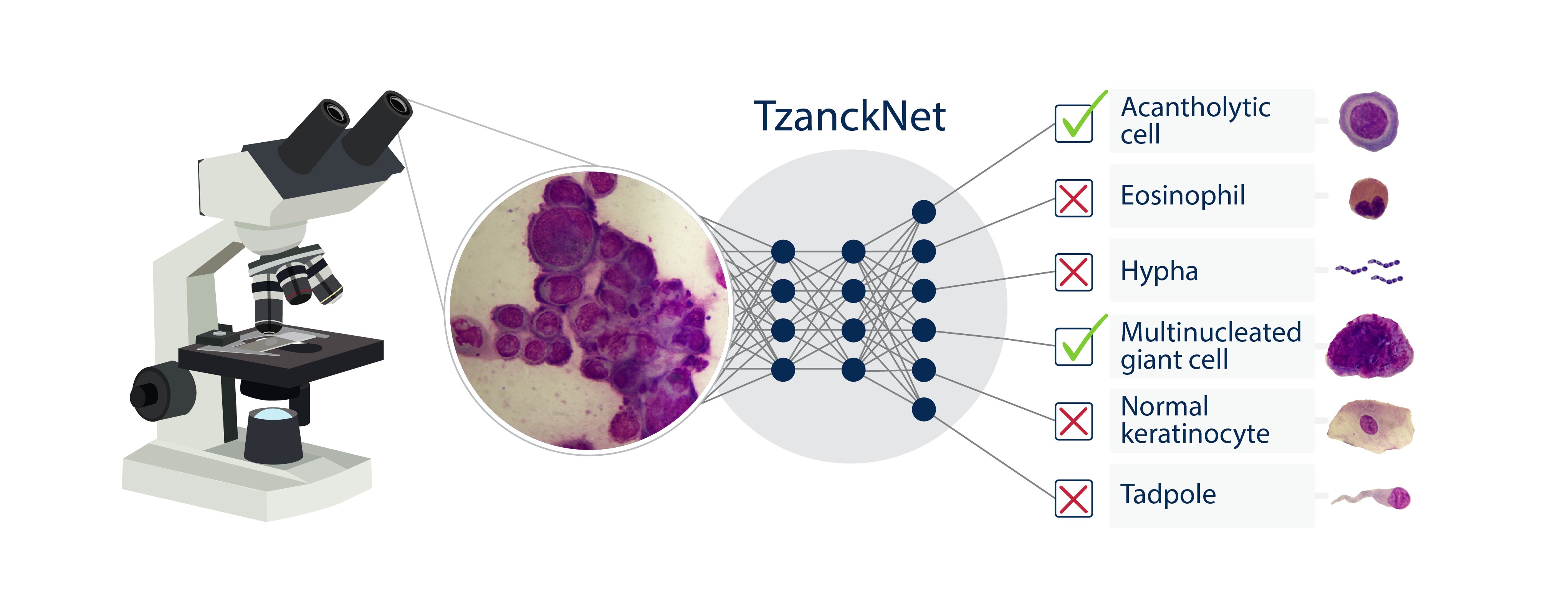 AN_TzanckNet_v17